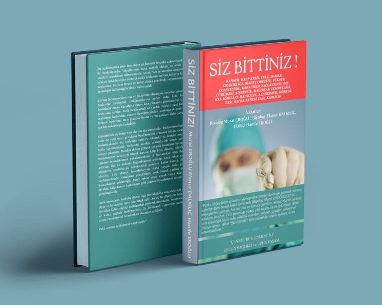 SİZ BİTTİNİZ / MURAT EROĞLU